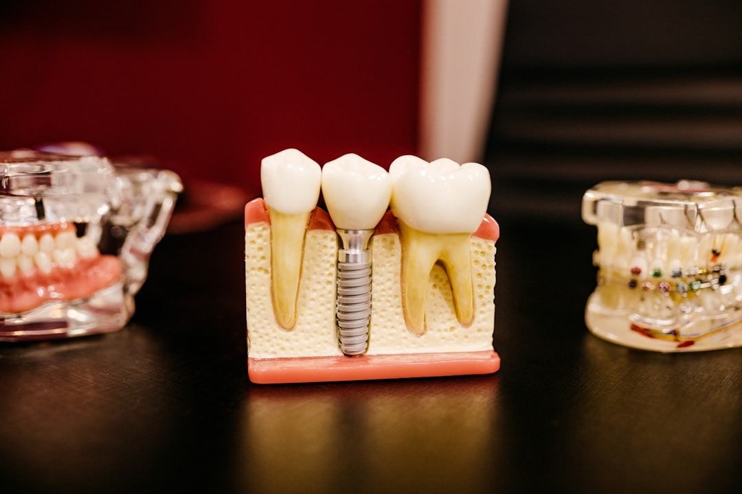 Dental implant